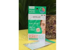 Лечебный пластырь для точечного лечения акне от Skynlab, Acne Patch 1 шт (10 пластырей)